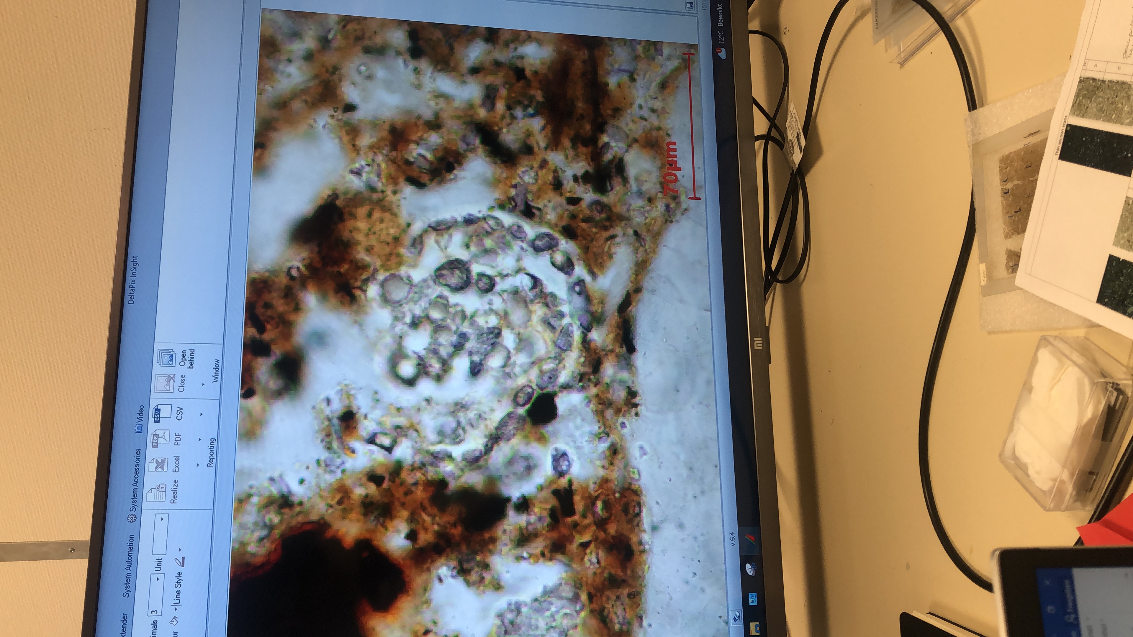 Microscope screen showing the focus was on phytoliths